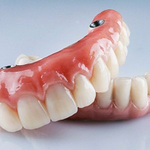 close up of implant dentures