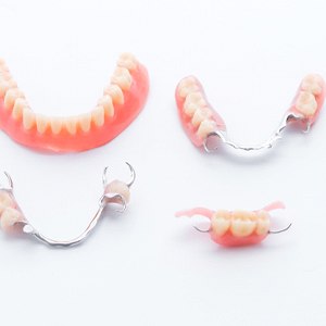 Different types of dentures in Flint