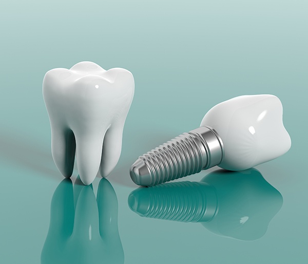 Animated dental implant supported replacement tooth and natural tooth