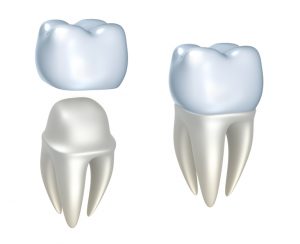 Your dentist in Flint discusses the uses and benefits of dental crowns.