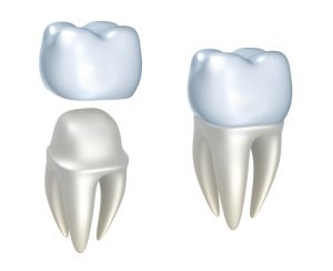 Your dentist in Flint discusses the uses and benefits of dental crowns.