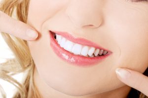 woman smiling with perfect teeth